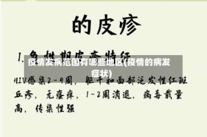 疫情发病范围有哪些地区(疫情的病发症状)