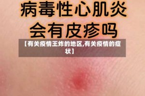 【有关疫情王炸的地区,有关疫情的症状】