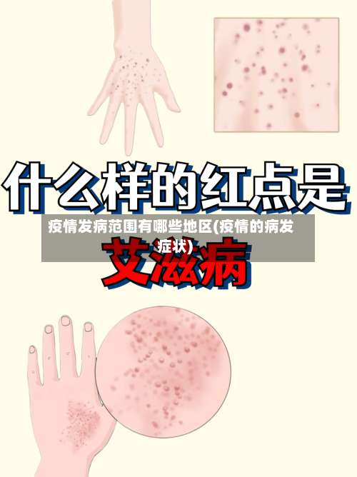疫情发病范围有哪些地区(疫情的病发症状)-第3张图片